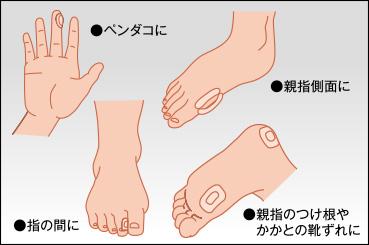 ソルボバン　フリータイプ７　ソルボバン　フリータイプ７