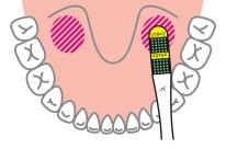 超薄型液晶体温計フラットミニ（業務用 100枚入）